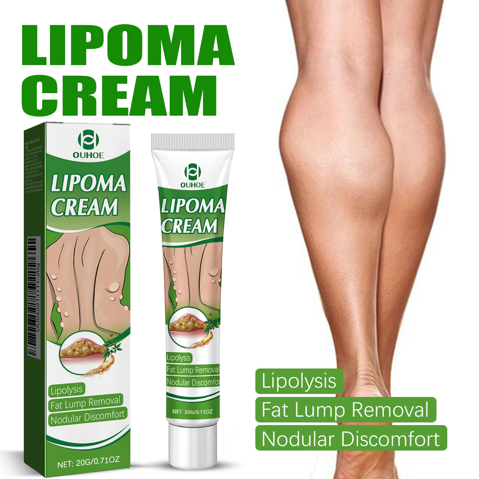 Ouhoe Fat Knot Cream Dredge Body Multiple Fat Lump Tumor Subcutaneous Lump Body Care Cream