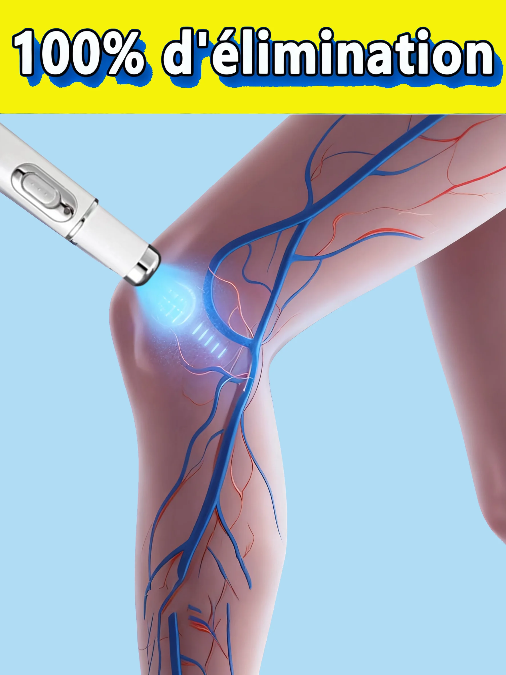 

Ручка Unisx с синим светом, улучшенный стиль второго поколения, решает варикозное расширение вен, горячая распродажа, инструменты для ухода за ногами