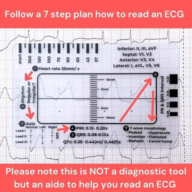Règle Transparente Portable à 7 Étapes pour l'Observation ECG, Outil de Mesure pour Interprétation ECG