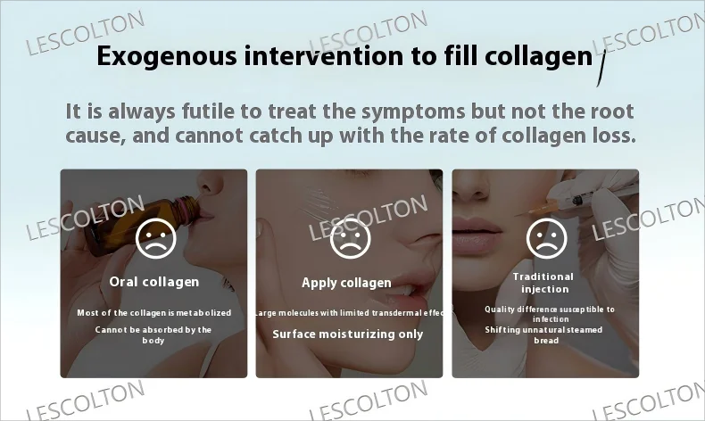 أداة مدفع التجميل للمكتبة الذكية للاستخدام المنزلي جهاز شد الوجه بالكولاجين لإزالة التجاعيد ورفع الوجه #5