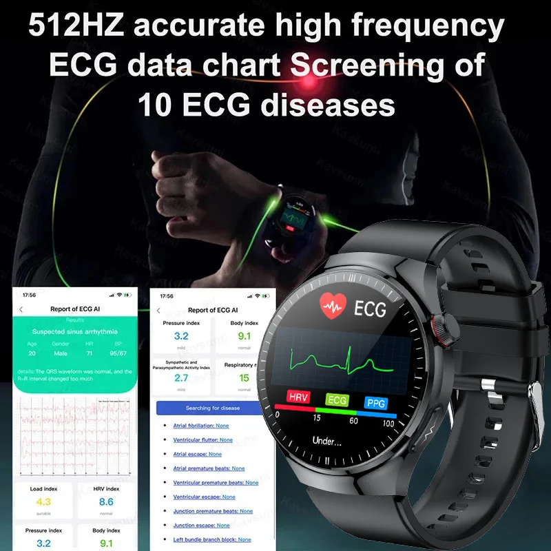 Smart Watch para Xiaomi IOS, Monitoramento de Saúde, Frequência Cardíaca, Pressão Arterial, ECG, Ácido Úrico, Sangue, Gordura, Novo, 2024