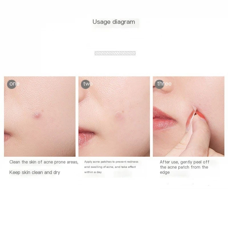 Plastry na trądzik w kształcie kreskówek z funkcją ssania Przenośne plastry w kształcie PE-60 Plastry Star PE Indywidualnie plastry G6U4