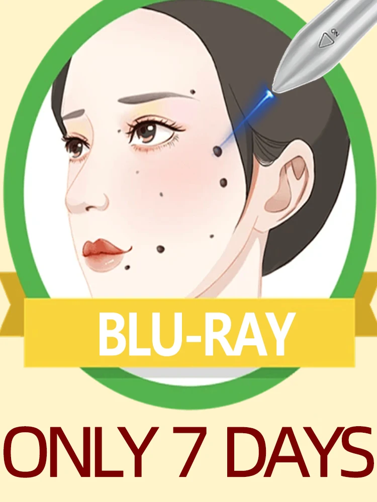 

Gᴇɴᴇʀᴀᴛɪᴏɴ-2 Lᴀsᴇʀ Sᴀʏs Gᴏᴏᴅʙʏᴇ Tᴏ ᴀʟʟ ᴡᴀʀᴛs Iɴ 7 Dᴀʏs