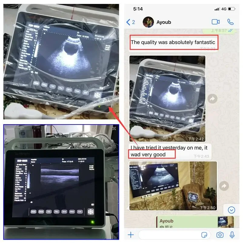 獣医用超音波スキャナー,市場で人気のあるモデル,タッチスクリーン付き