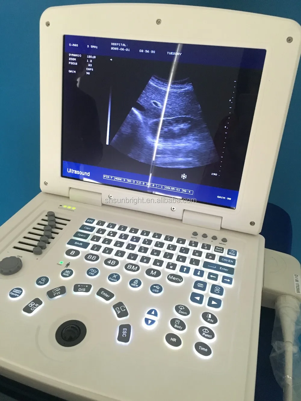 Cheap Ecograph Laptop notebook price veterinary ultrasound machine SUN-806G