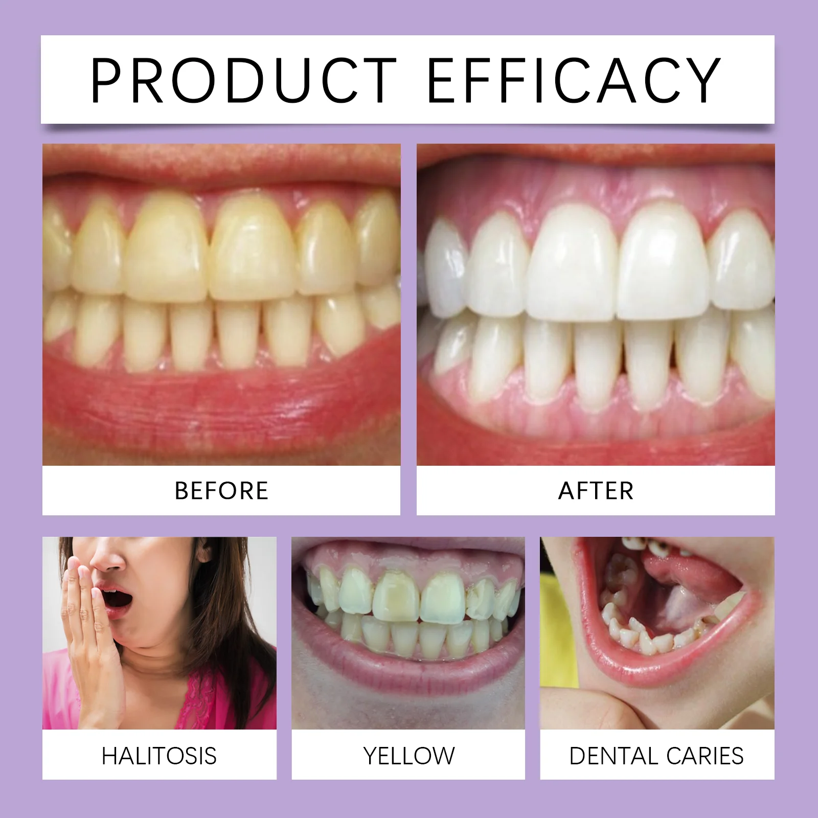 قلم العناية بالأسنان الأرجواني ينظف الفم لإزالة بقع الدخان بقع الشاي بقع الأسنان منعش تنظيف مريح للأسنان 2026