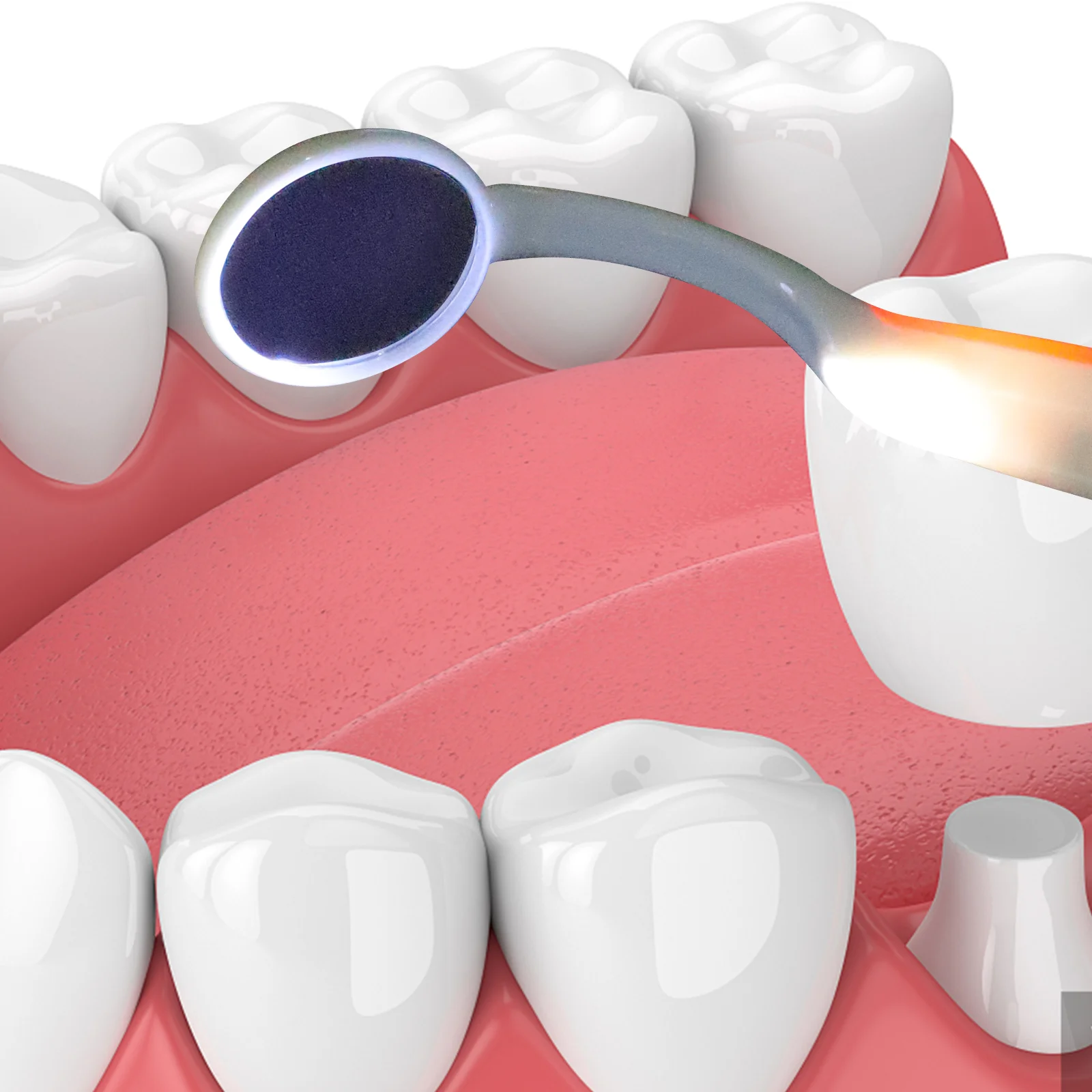 Espejo Dental Oral de 2 uds., espejo de inspección de dientes con luz LED brillante para el cuidado Dental (verde y naranja)