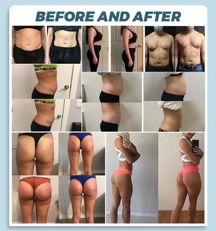 2025 EMSzero 6500 Вт 15 Tesla Neo Черное Золото RF EMS Скульптурная машина Технология похудения жира Стимуляция мышц Скульптура Синий