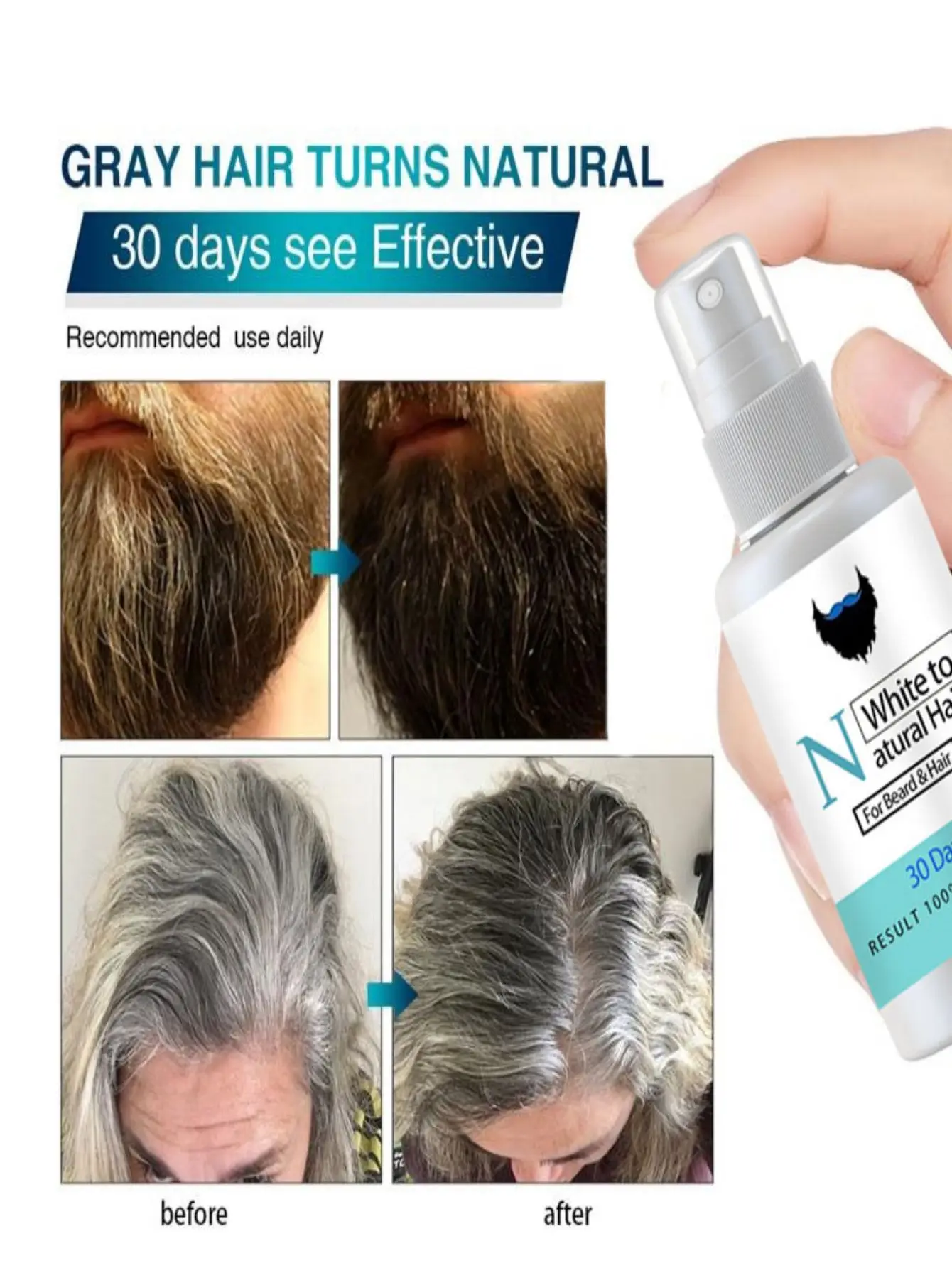 2023 New Beard Hair Restore To Natural Hair Color Spray for Unisex Herbal Cure White Gray Hair Treatment Tonic