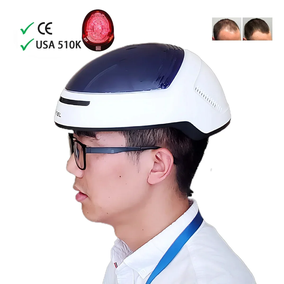 

Kernel 8000b Инфракрасная светодиодная светотерапия 810 нм Фотобиомодуляция Мозговой шлем PDT Машина для лечения