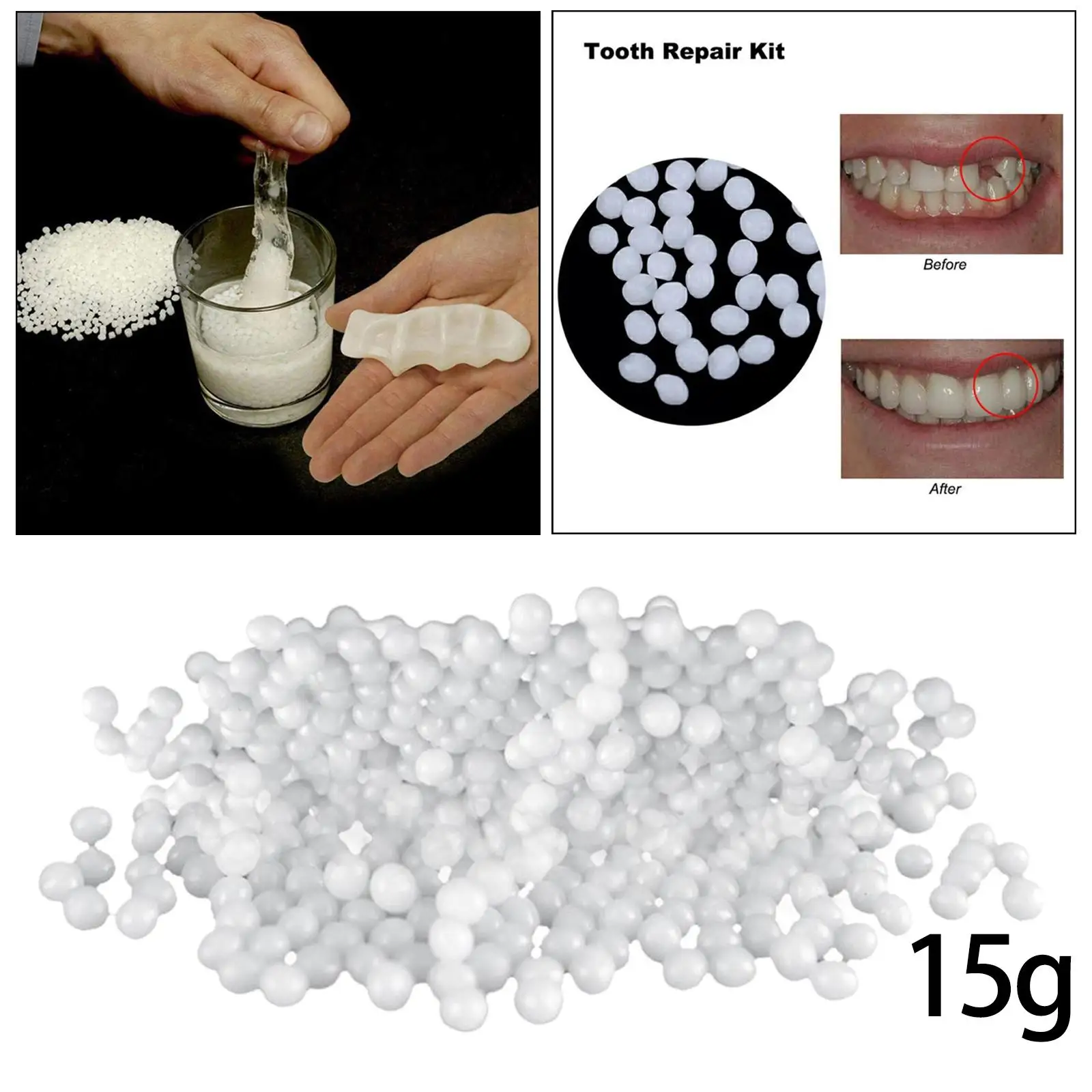 Temporary Tooth Repair Kit Filling The Missing Broken Tooth and Gaps