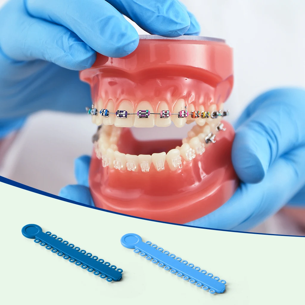 1040 Stück/Packung AZDENT Dental Kieferorthopädische Elastische Ligaturen Bänder Ligationsringe 48 Farben Zahnmedizinische Materialien – Detail 2
