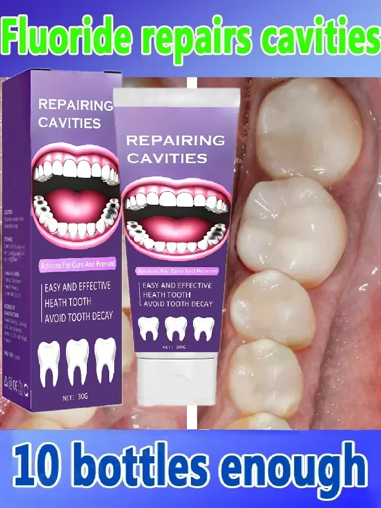 Best-selling, scientific fluoride repairs cavities, removes cavities, cleans plaque, whitens teeth, and freshens breath