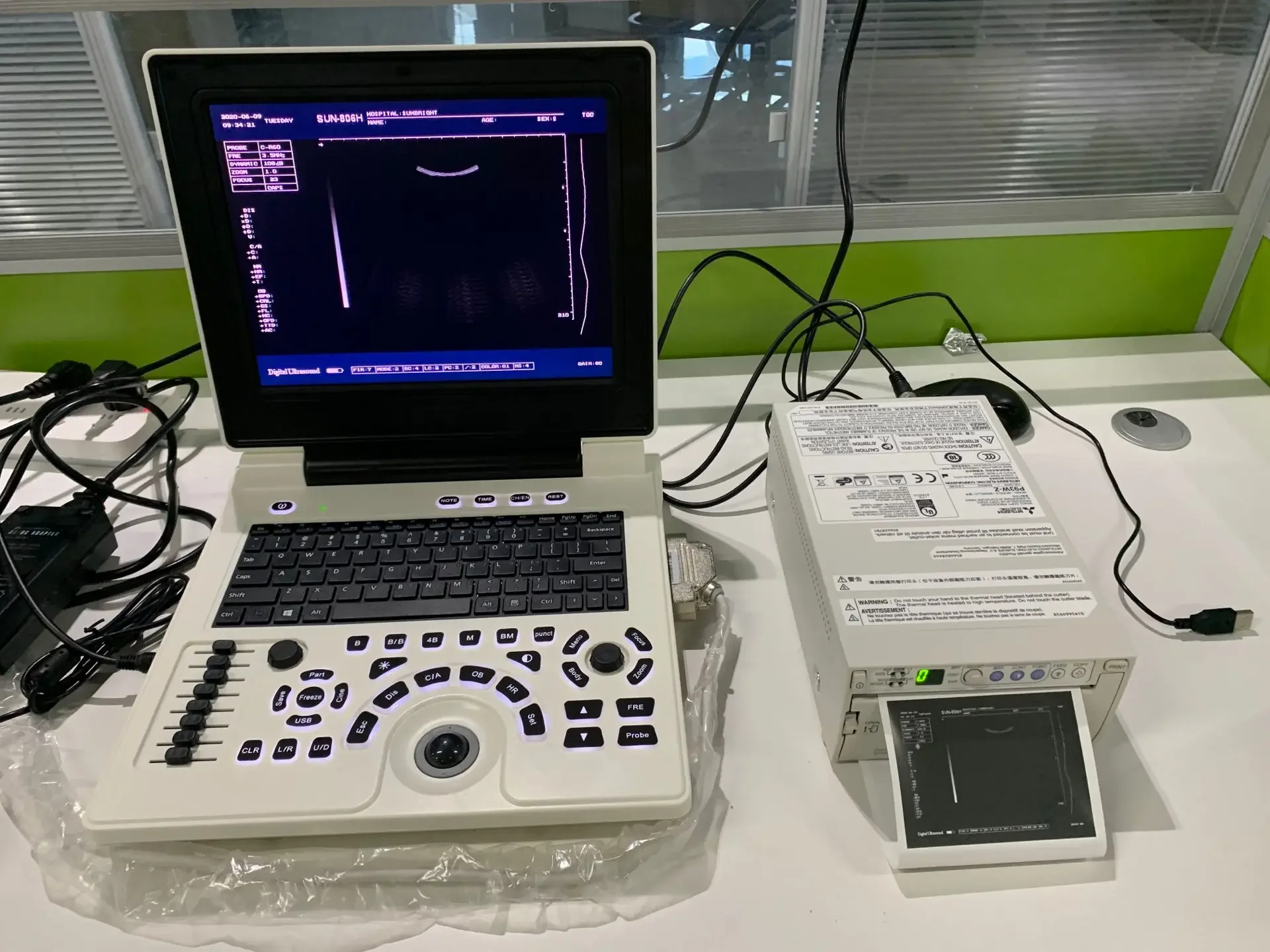 sonosite m turbo ultrasound machine with 2 Probe Connectors