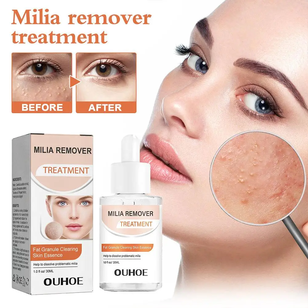 30ml Milia Clearing Essence Remover Essence Fat Granule Serum Anti Eye Milia Clearing Aging Anti Acne Skin Under Essence Re O9U7