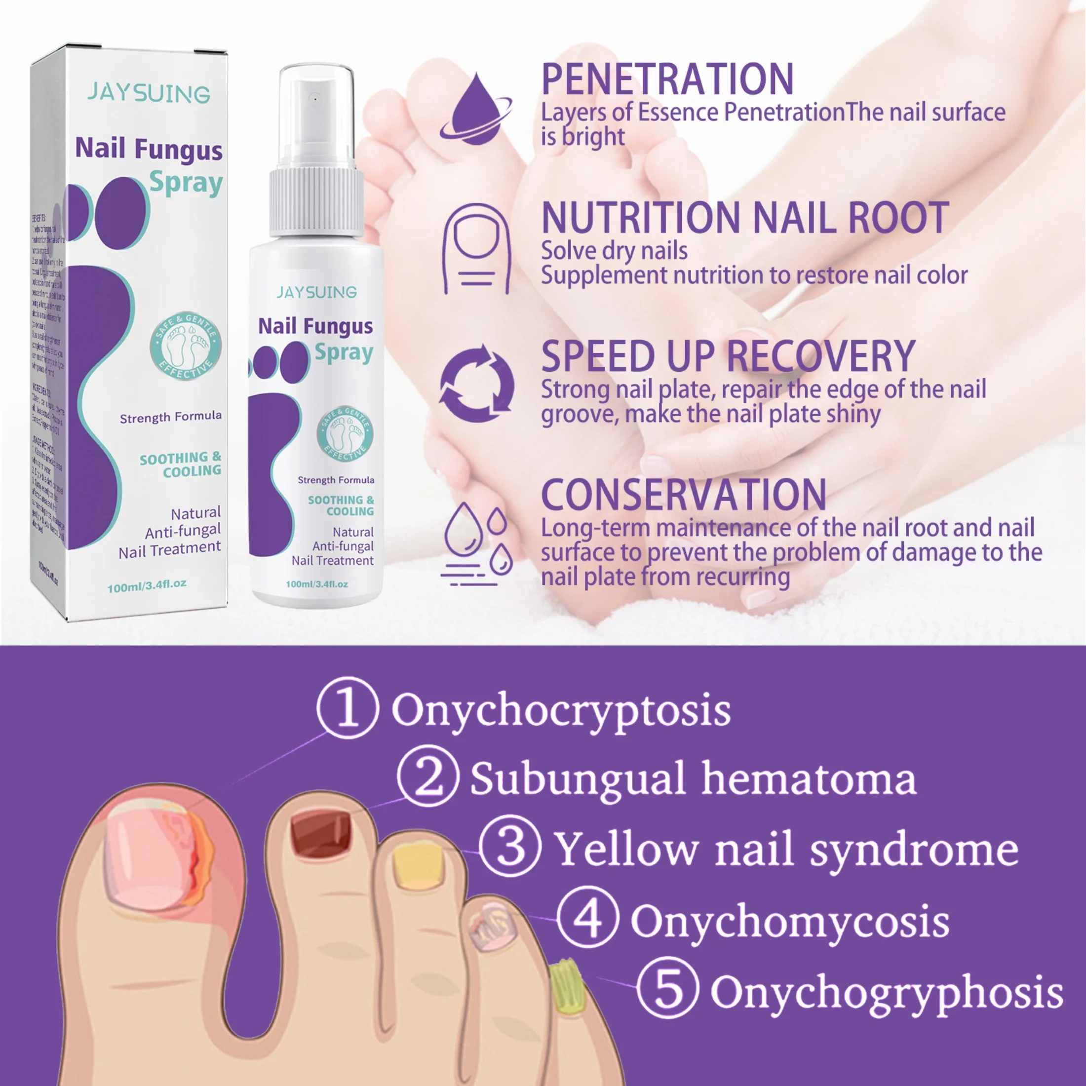 

Hands Nail Sweaty Foot Spray Combat Feet Spray Herbal Toe Care Onychomycosis 100ml Nail Strengthener Remove Feet Odor Mist