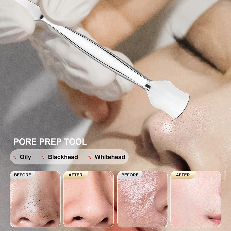 Comedondrukker Puistje Popper Tool Acne Verwijderen Behandeling Comedo Whitehead Popping Zit Neus Gezicht Smet Extractor