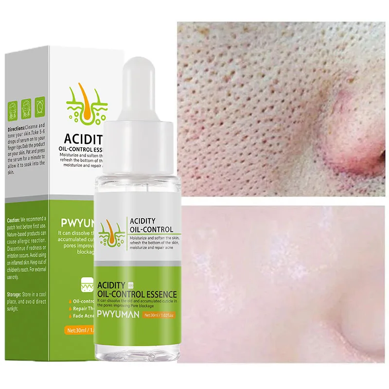 

Acid Propolis Pore Shrinking Facial Serum Blackhead Removal Acne Oil Control Moisturizing Repair Nourishing Pore Tightening Smoo