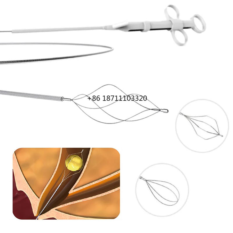 Gastrointestinal Endoscopic Nitinol Stone Retrieval Basket Stone Extraction Basket Disposable Stone Extraction Basket