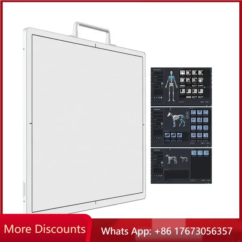 17*17 Inch Iray DR wireless flat panel detector Medical X Ray Equipment Wireless Digital X-ray flat panel detector