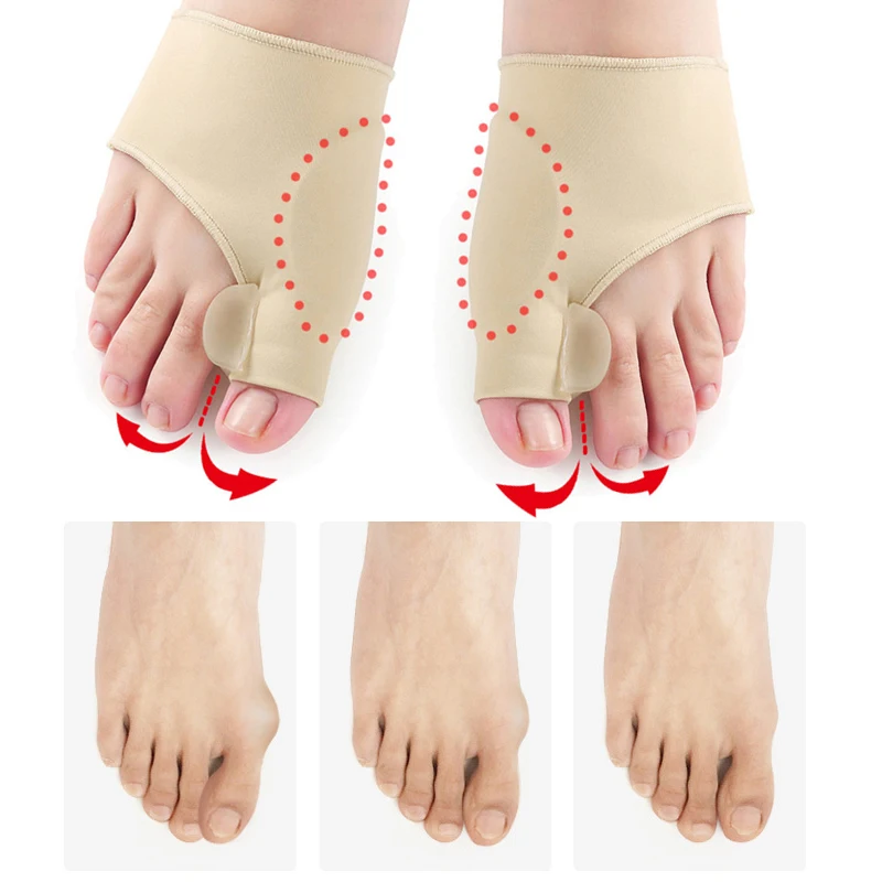 1Pair Big Bone Orthopedic Bunion Toe Separator Hallux Valgus Foot Care Correction Pedicure Braces Toes Separator