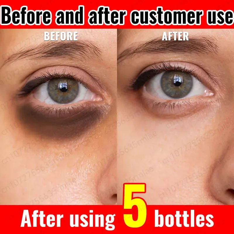 

Hot Anti-Wrinkle Eye Cream Dark Circles Remove Eye Bags Puffy Eyes Reduce Wrinkles Fine Lines Remover Eye