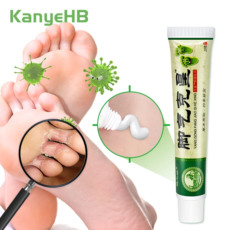 

1pc Beriberi Pedis Treatment Cream Chinese Medicine Ointment Anti-itch Inhibits Fungus Peeling Foot Medical Cream S049