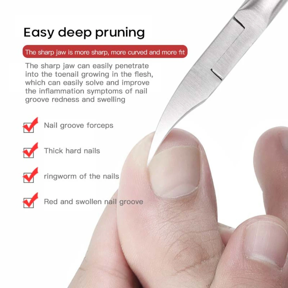 Effective Toenail Ingrown Durable Stainless Steel Precision Versatile Dead Skin Remover Smooth And Pain-free Trimming Paronychia
