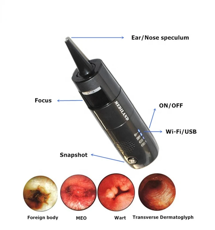 ML-402 Digital wifi microscope support IOS/Android/WIndows with HD video household wifi otoscope wireless Endoscope