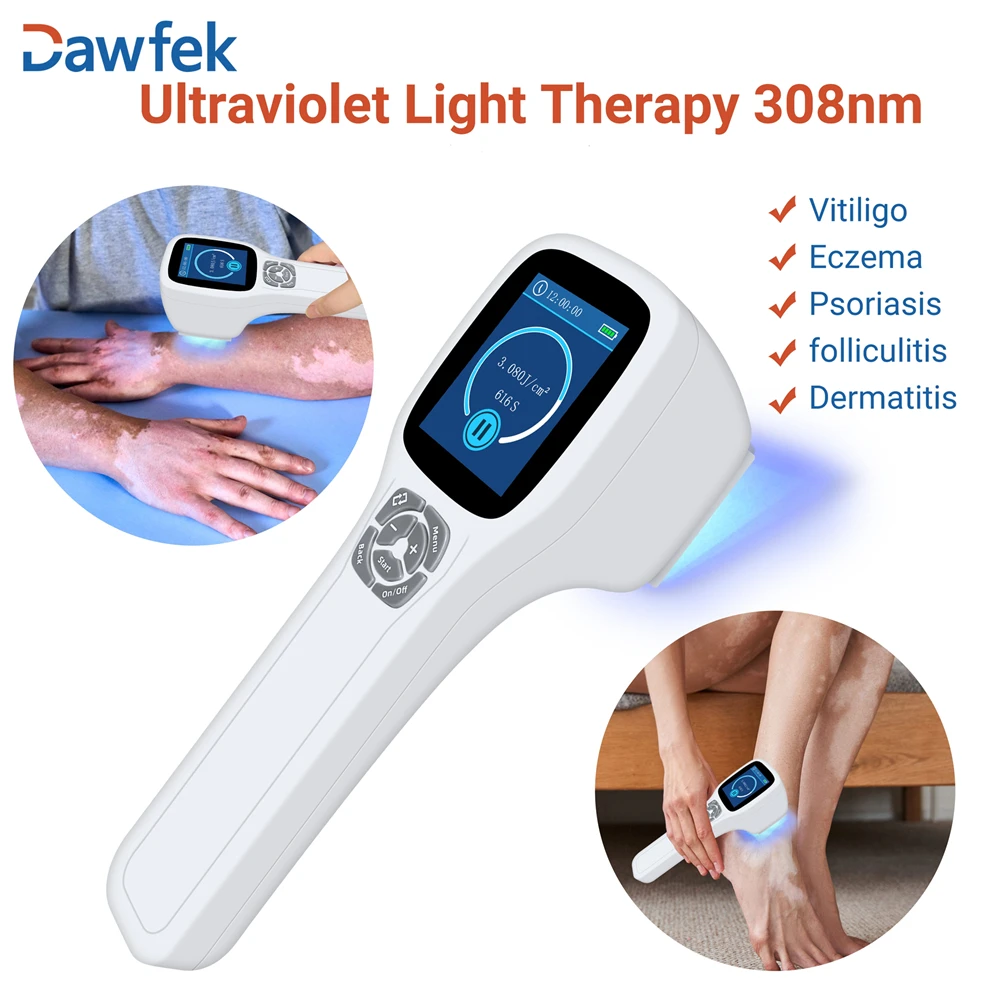 Dawfek Portable 308nm Excimer Phototherapy Device UV Therapy for Vitiligo Eczema Psoriasis Allergic and Pigmentary Skin Disease