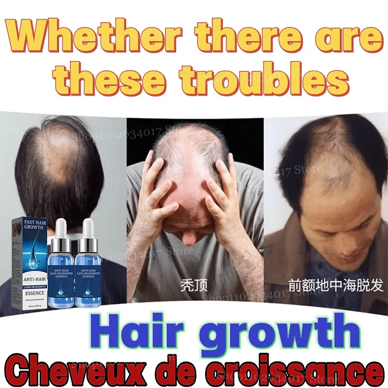 

Bid Farewell to Hair Loss, Hello to Growth
