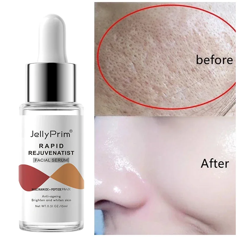 Niacinamida Dark Spot Remover Soro, Hidratante Clareamento Facial, Remoção de ácido hialurônico Soro Facial Sarda, Cuidados com a pele