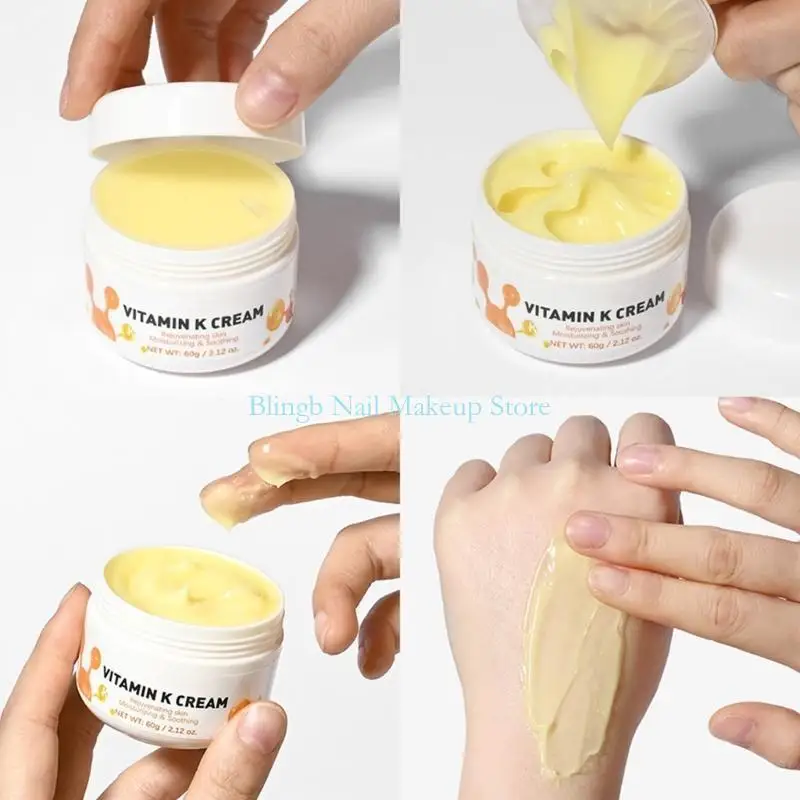 28TA 60g Vitamin K Cream for Bruises,Spiders Veins,Dark Circles,Broken Capillaries,Eyes,and Face Varicose Vein Cream Gifts