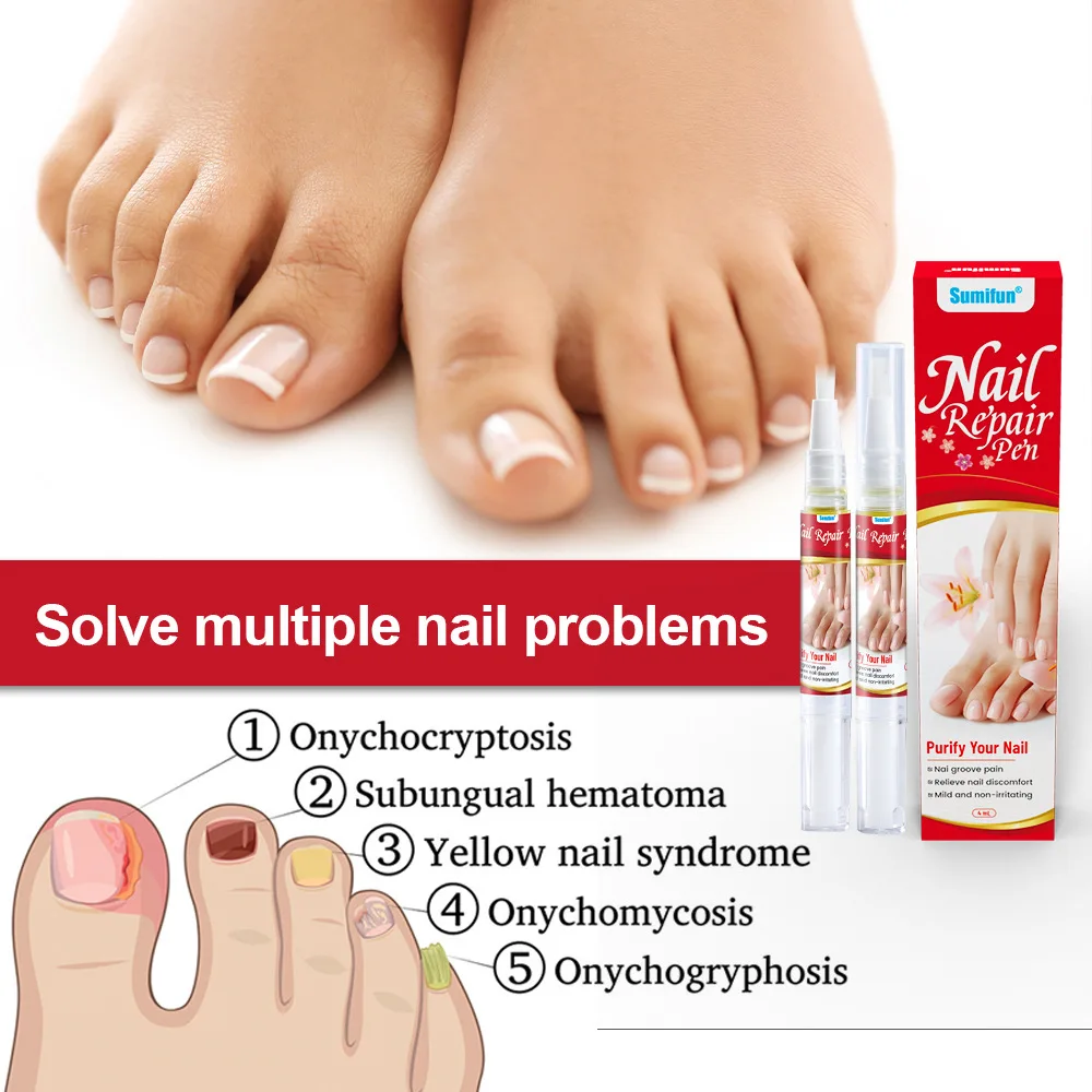 真菌性爪治療血清爪真菌除去治療爪周囲炎液体抗灰色爪足指感染症足修復ケアツール