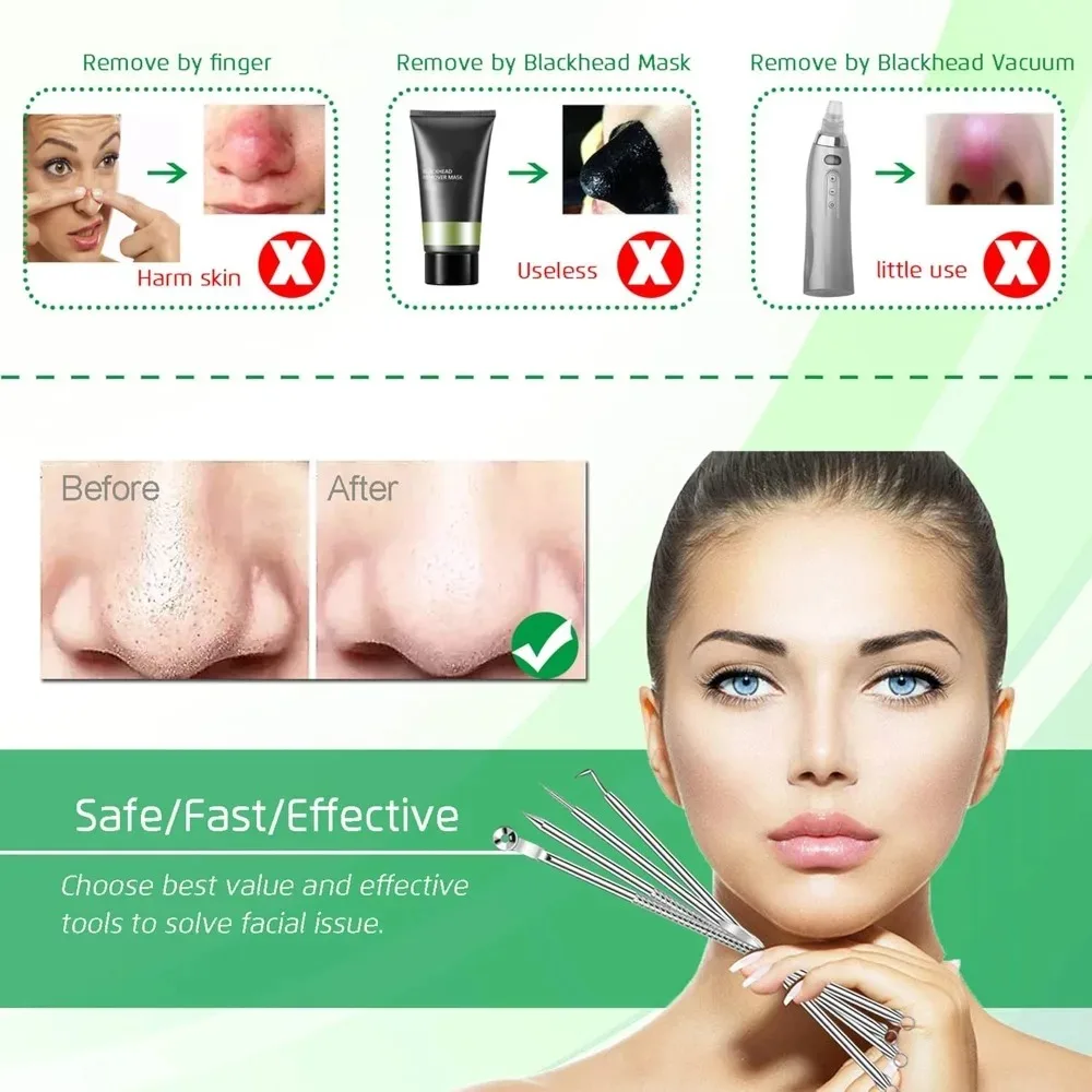 الفولاذ المقاوم للصدأ حب الشباب كليب بثرة إبرة مزيل الرؤوس السوداء الملقط Comedone النازع الوجه صالون تجميل أدوات العناية بالبشرة #5