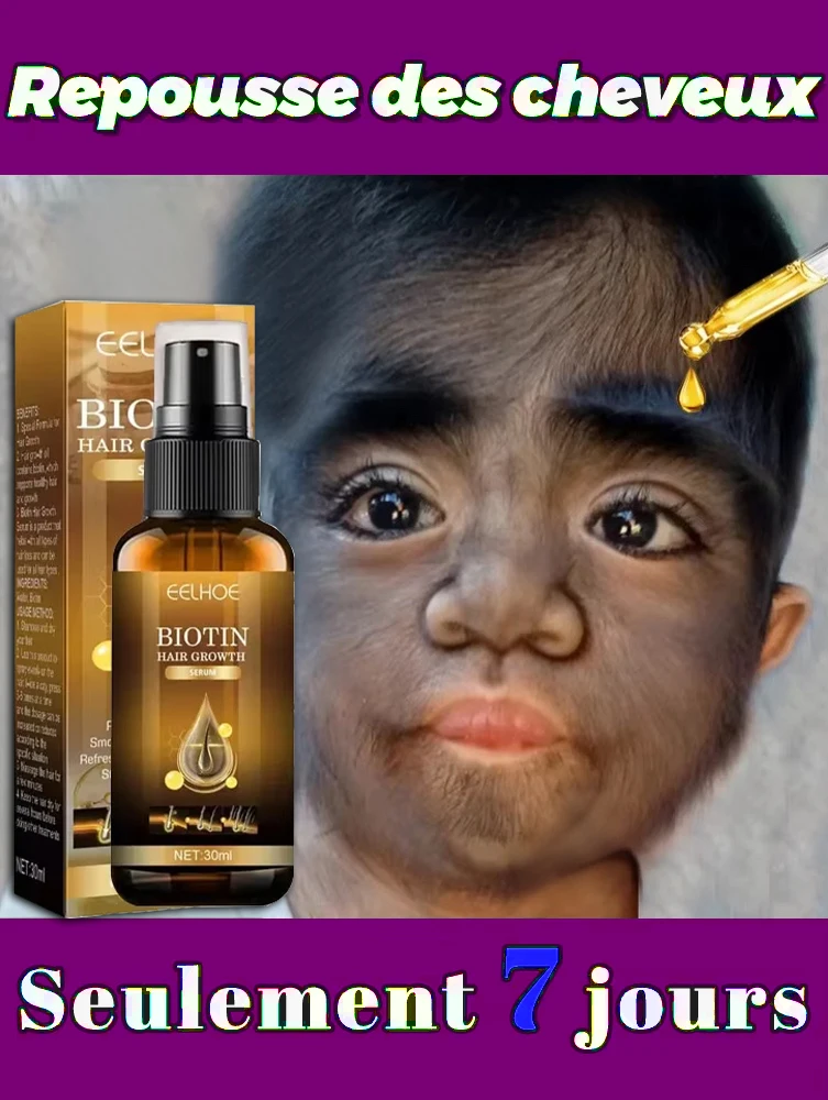 

Восстанавливает волосы, сильное проникновение, активация корней волос, больше волос, попрощайте о облысение, Алопеция Авреа, густые волосы.