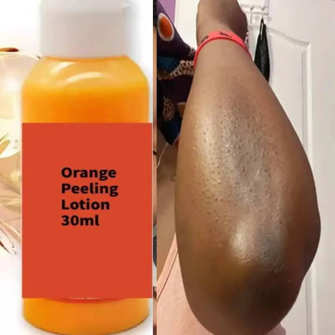 Peeling Cream Dark Knuckles Knees Toes Large Areas on The Body Orange Body Lotion Extra Strength