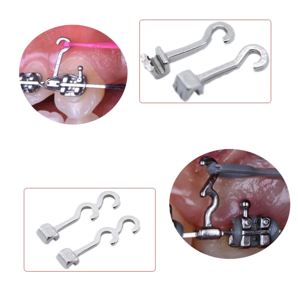 10Pcs Orthodontic Bondable Lingual Buttons, Crimpable Traction Hooks L/R, Mesh Base, Dental Accessories