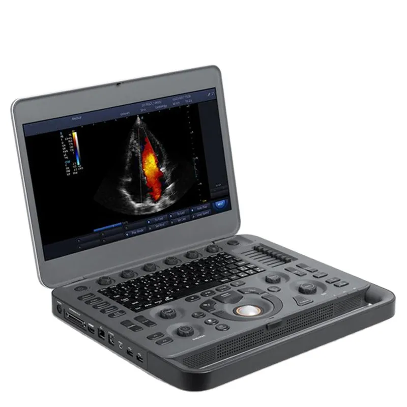 Sonoscape X5 portable 4D color doppler ultrasound machine for sale