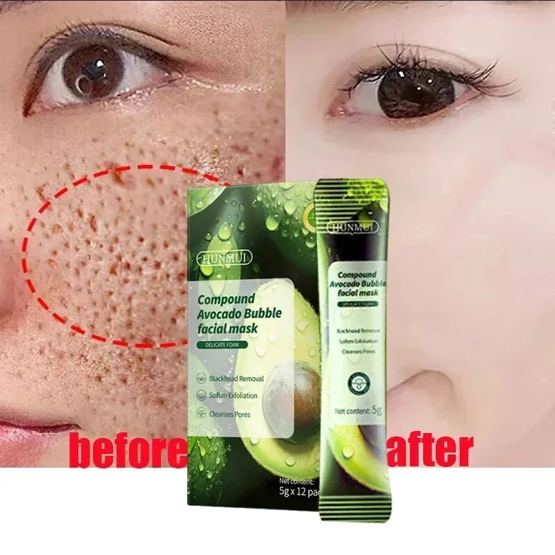 

Salicylic Acid Pore Shrinking Mask Quick Elimination Large Pores Remove Blackehead Tighten Face Smooth Skin Korean Care Product