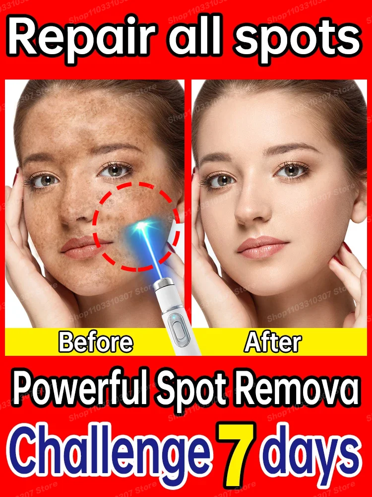 Makes Facial Spots Disappear