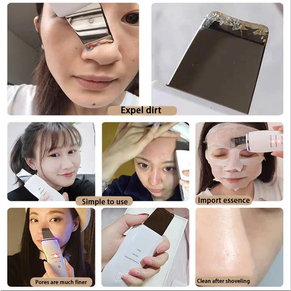 Electric Skin Scrubber Peeling Blackhead Remover Deep Face Cleaning Lifting Ion Acne Pore Cleaner Facial Spatula Shovel Cleanser