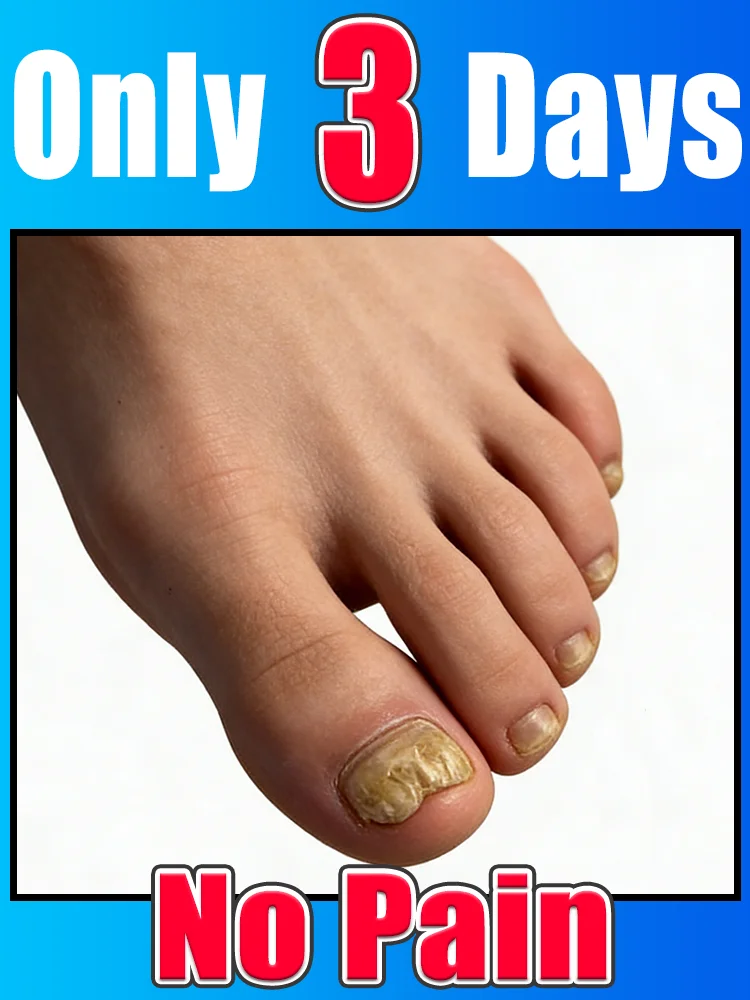 

Break away from rough dull nails, fingertips stay soft glossy