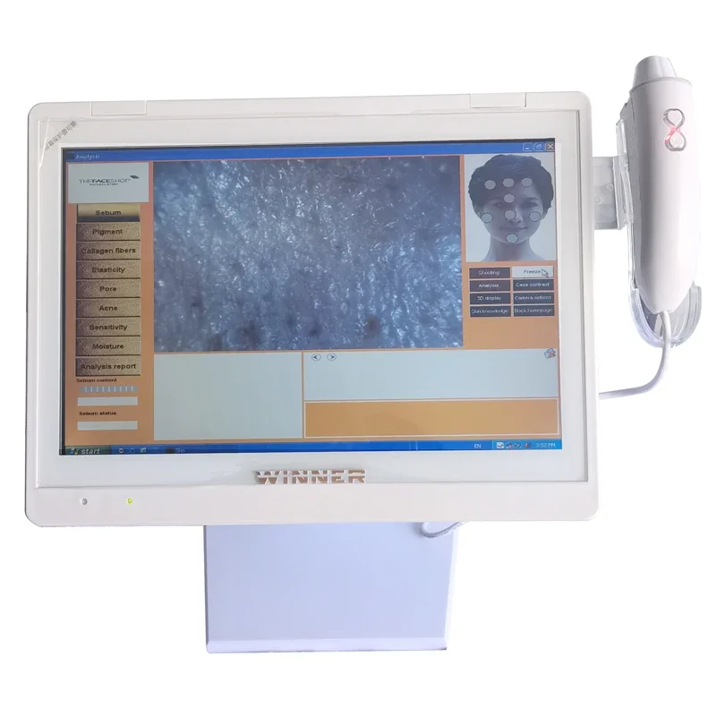 All in one skin analyzer machine professional scalp detector