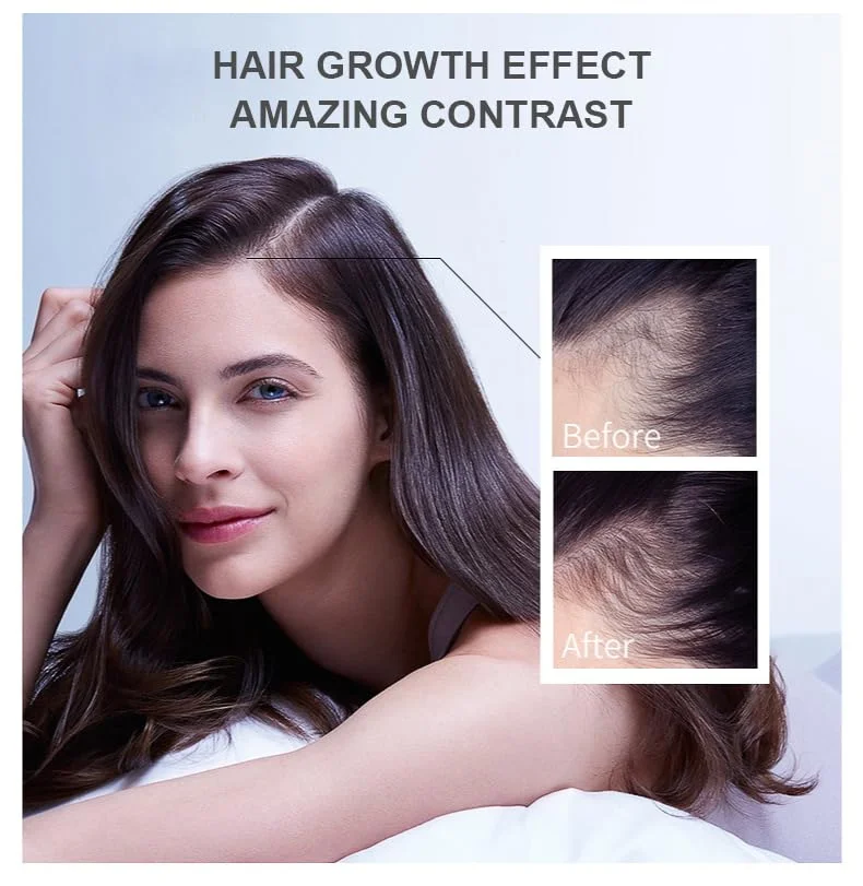 Hair Growth Oil Ginger Biotin Serum Natural Hair Loss Treatment for Men Women Thicker Hair Repair Scalp Care Essential Oil Set