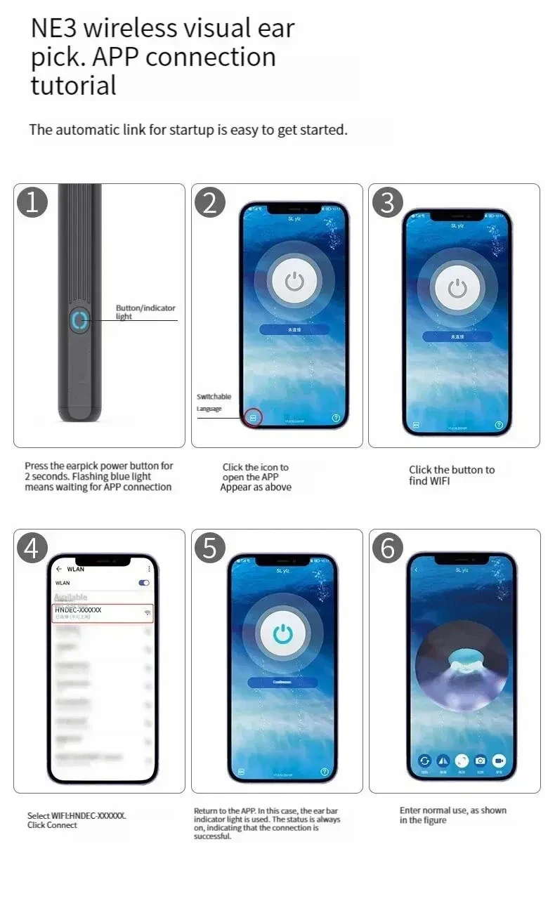 TINSOL Smart HD Visueller Ohrenreiniger 1080P Ohrenschmalz-Entferner Otoskop USB-C Wiederaufladbares Endoskop Ohrenschmalz-Reinigungswerkzeug Gesundheitspflegeset – Detail 15