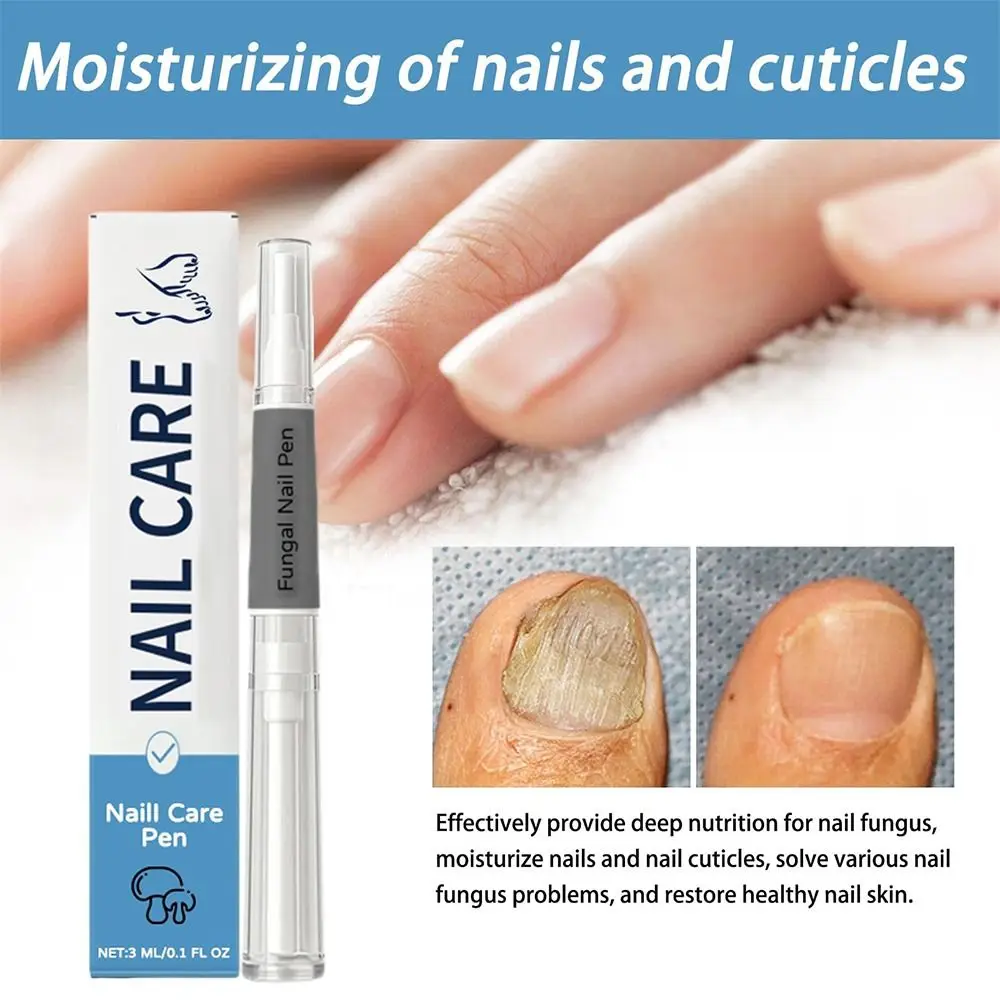 Nagelhautöl Nagelpilz Stiftbehandlung Serum Advanced Formula Advanced Nail Care Pen Pilznagelstift Zehennagelbehandlung
