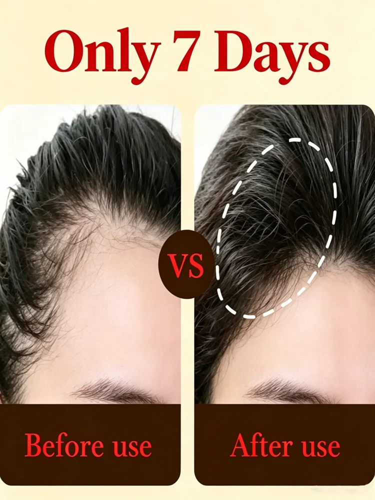Stops hair loss and promotes hair growth; nourishes the scalp and hair follicles | Suitable for both men and women
