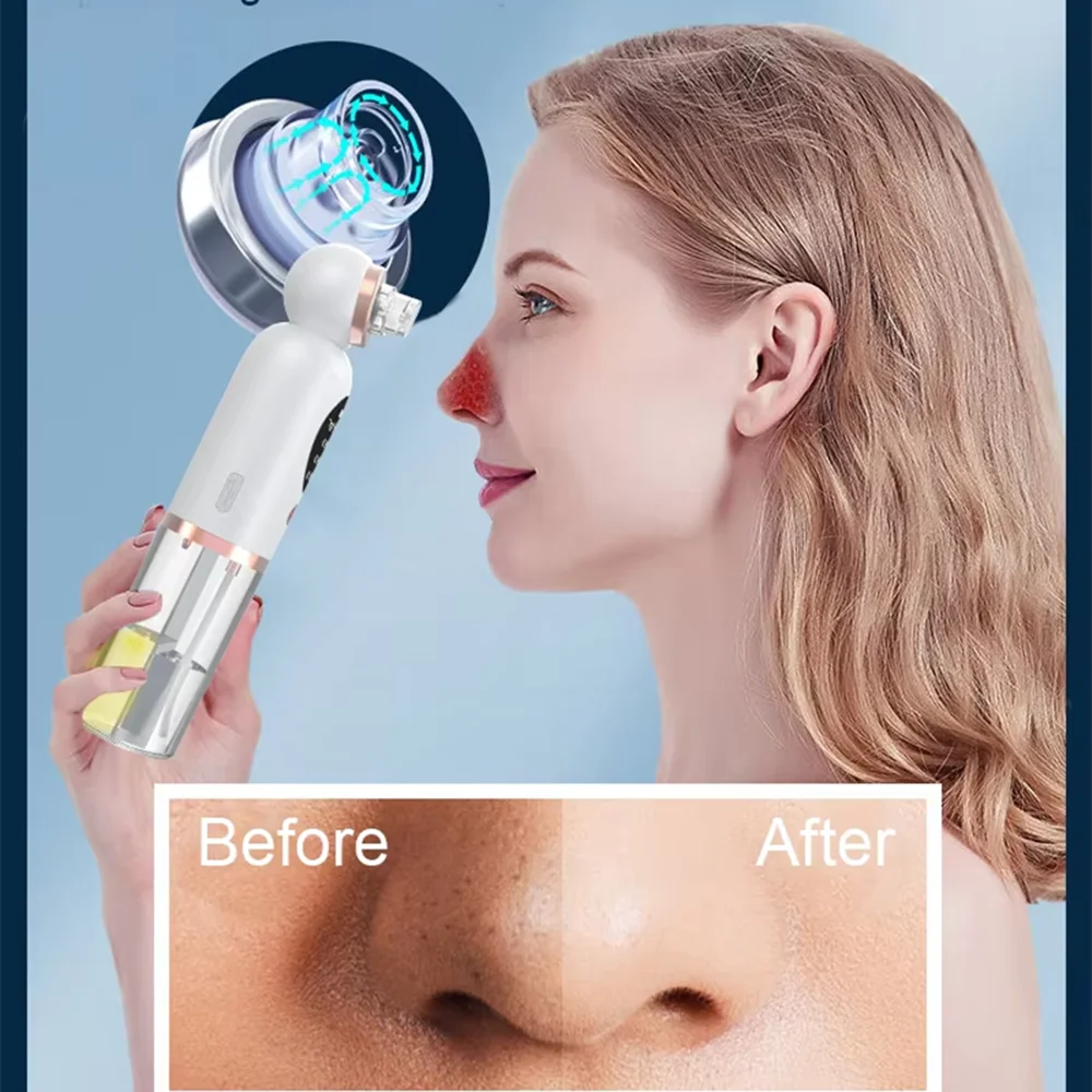 

Electric Pore Cleaner Machine Household Blackhead Removal Tool