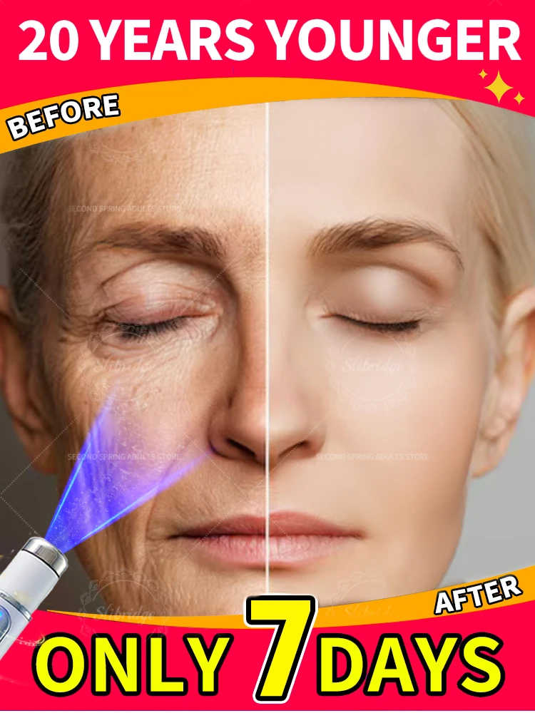 

20 years younger Erase Wrinkles in Just 7 Days